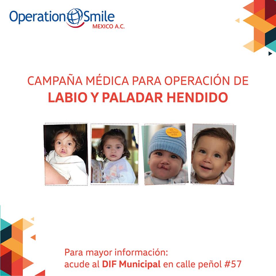 Campaña Médica Para Operación De Labio Y Paladar Hendido Gobierno Municipal Nochistlán 9851